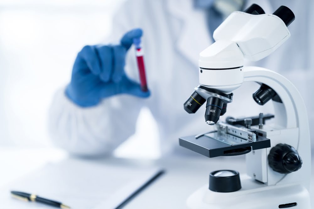 Laboratory scientist holding a blood sample tube next to a clinical microscope representing the comprehensive lab tests before TRT that confirm testosterone deficiency and establish baseline hormone levels